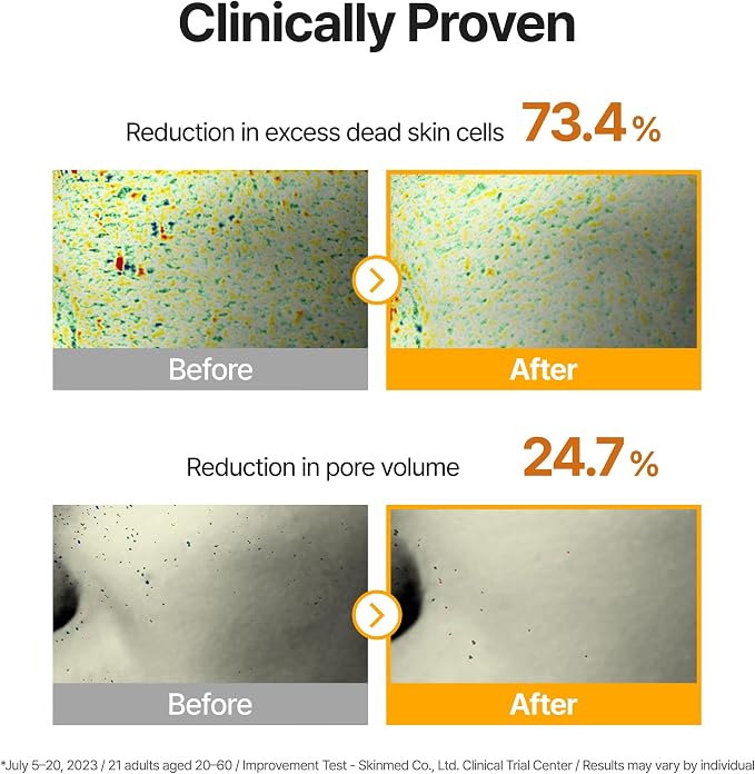 Dark Spot Correcting & Pore Refining Pads