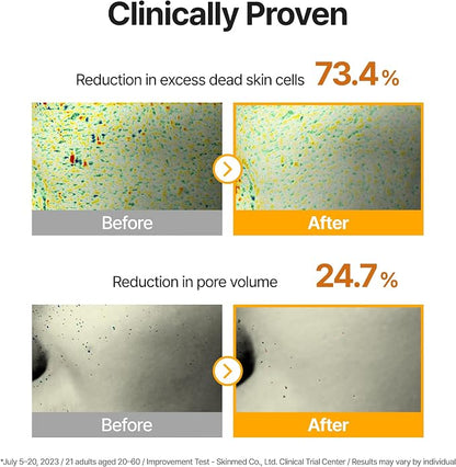 Dark Spot Correcting & Pore Refining Pads